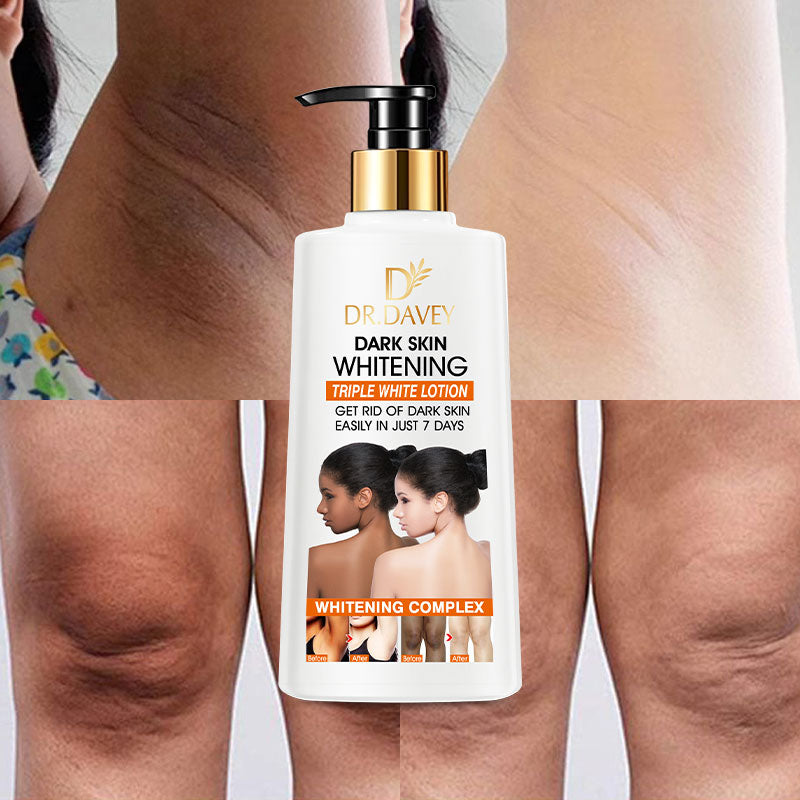 “Dr. Davy Lightening Body Lotion – Dark Spot & Uneven Tone Care for Underarms, Elbows & Knees 500 ml”