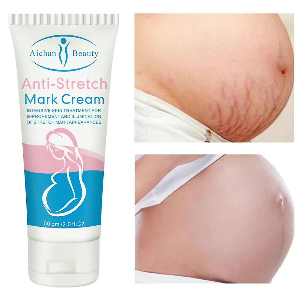 Anti Stretch Mark Care Cream