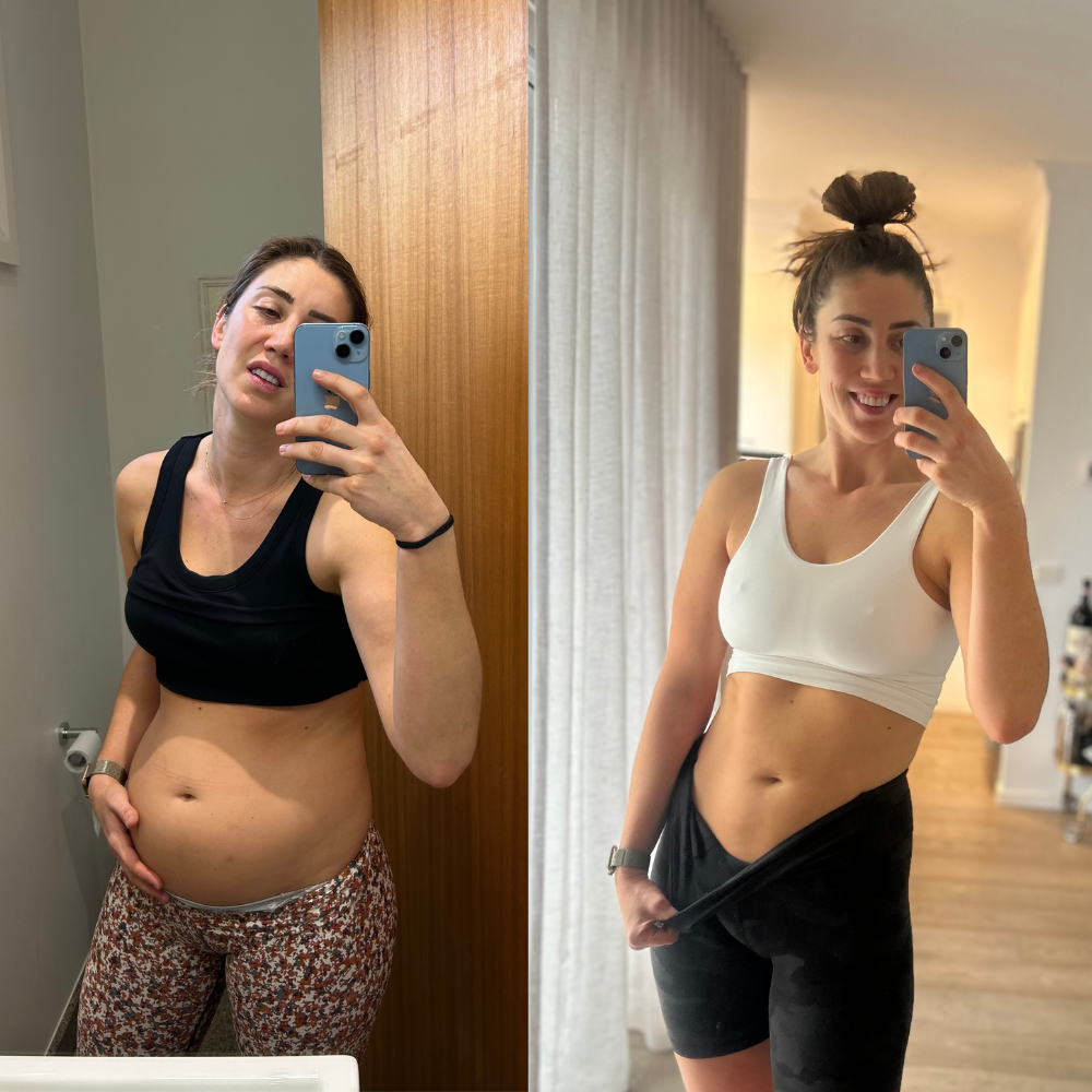 Flat Tummy , Flat Stomach Extra Strength Apple Cider Vinegar Gummies Dietary Supplement – Natural Apple Flavor” (60 gummies)