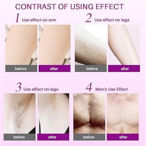 Instant Hair Removal Spray Foam – Smooth Skin Care Formula - African skincare