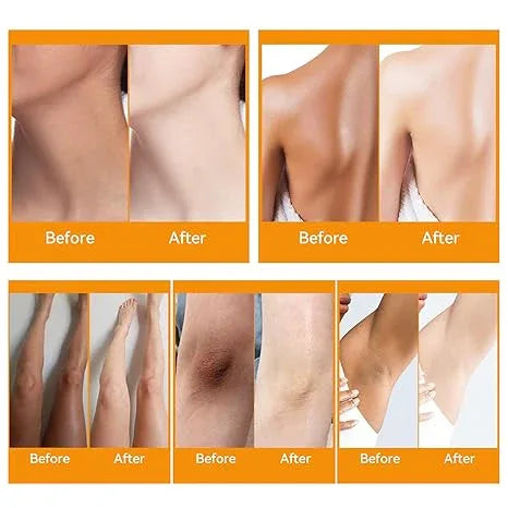 Turmeric Face Serum for Dark Spots &amp; Uneven Skin Tone – Brightening, Acne-Fighting &amp; Glowing Skin Formula - African skincare