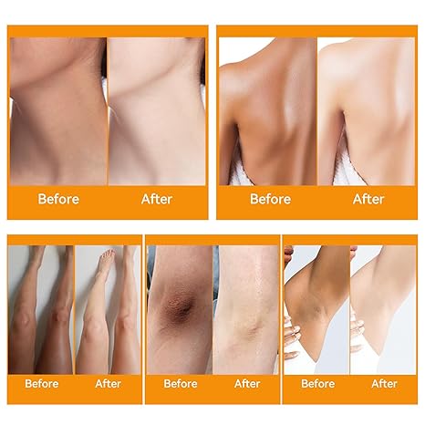 Lemon Dark Knuckle Remover Underarm Cream Dark Toe Knuckles Treatment Removal Remover Corrector for Armpit Knees Elbow Inner Thigh Neck Private Part Intimate Skin Cream 120g