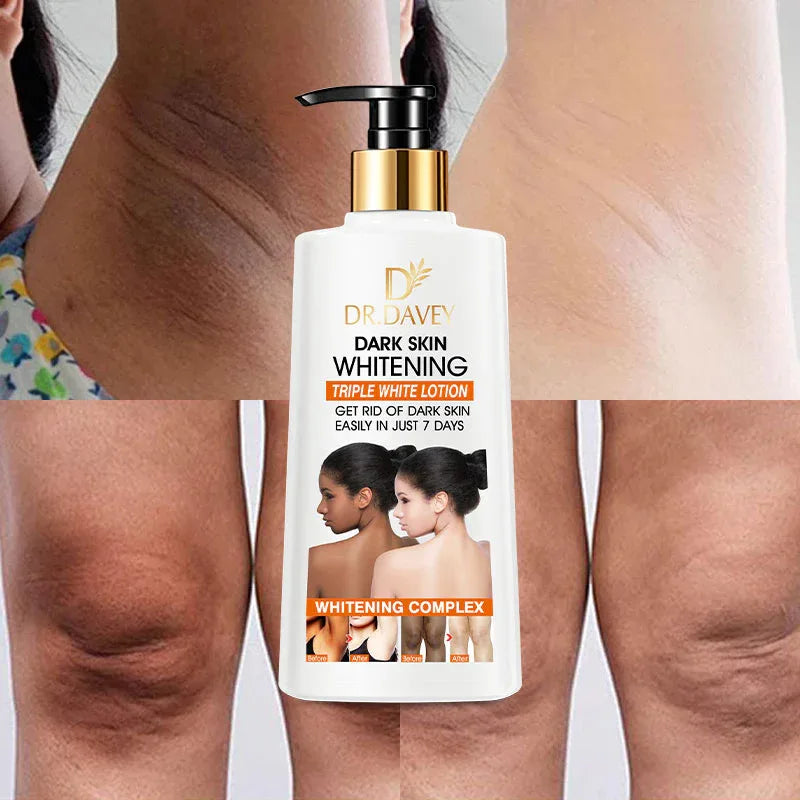 “Dr. Davy Lightening Body Lotion – Dark Spot & Uneven Tone Care for Underarms, Elbows & Knees 500 ml” - African skincare