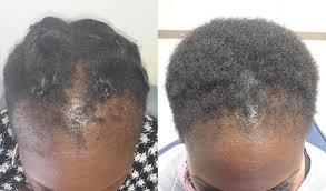 “Pure Batana Cream – Multi-Purpose Natural Hair, Beard, Scalp & Skin Care for Men and Women, Deep Conditioning & Hydration” - African skincare