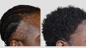 “Pure Batana Cream – Multi-Purpose Natural Hair, Beard, Scalp & Skin Care for Men and Women, Deep Conditioning & Hydration” - African skincare