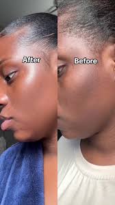 Raw African Black Soap Bar (150 Grams). - 100% Pure Natural From Ghana. Acne Treatment, Aids Against Eczema & Psoriasis, Dry Skin, Scars and Dark Spots. Great For Pimples, Blackhead, Face & Body Wash.